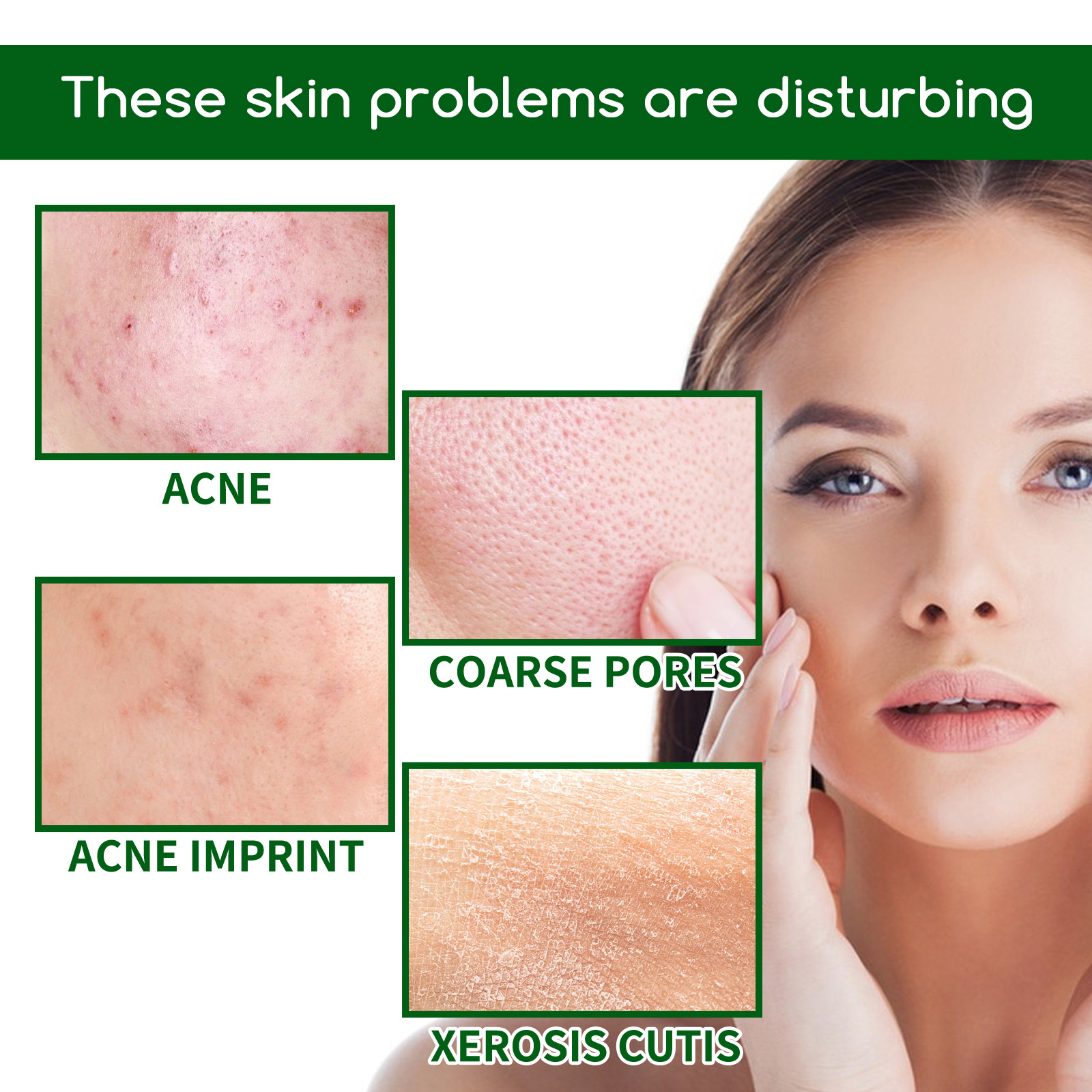 Salicylic Acid Anti Acn-e Face - مراجعة Glycolic Acid Exfoliant وسعره