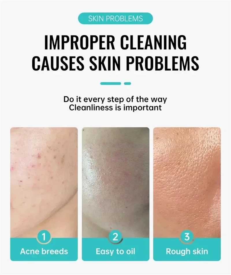 Salicylic Acid Acne Treatment  - مراجعة Salicylic Acid Cleanser وسعره