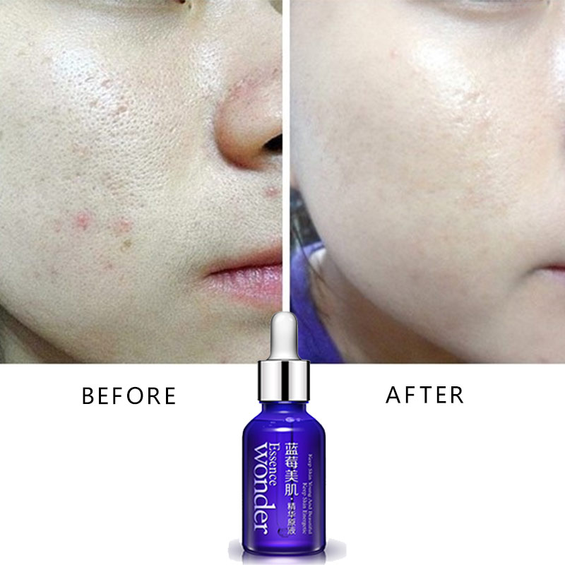 BIOAQUA Blueberry Face Lifting - مراجعة Skincare Garnier وسعره