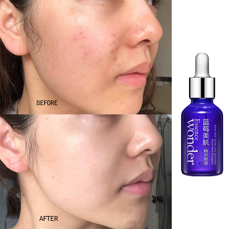 BIOAQUA Blueberry Face Lifting - مراجعة Skincare Garnier وسعره