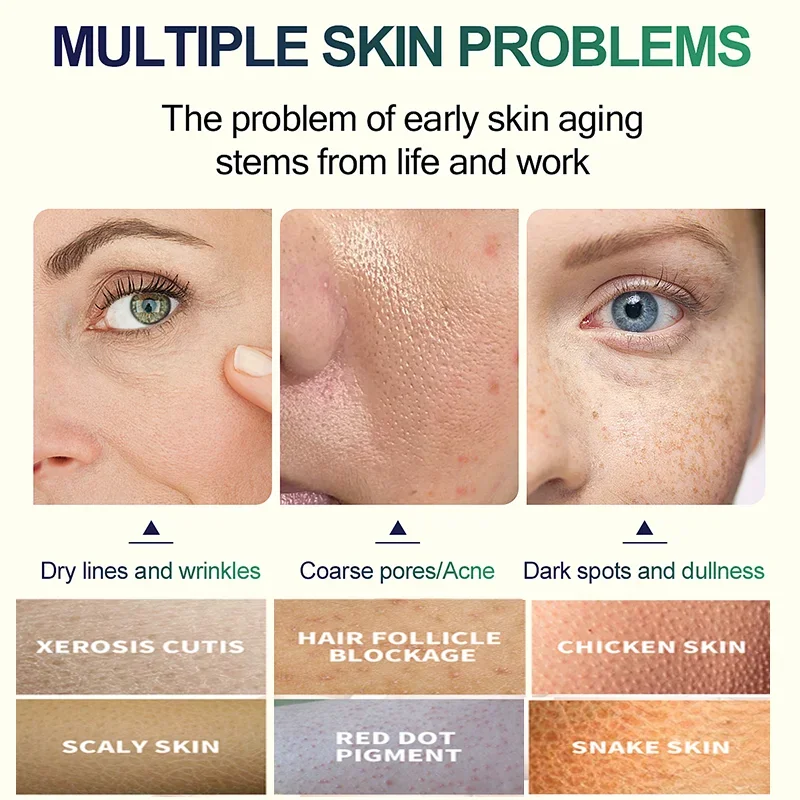 2ND Salicylic Acid Face Facial - مراجعة Glycolic Acid Exfoliant وسعره