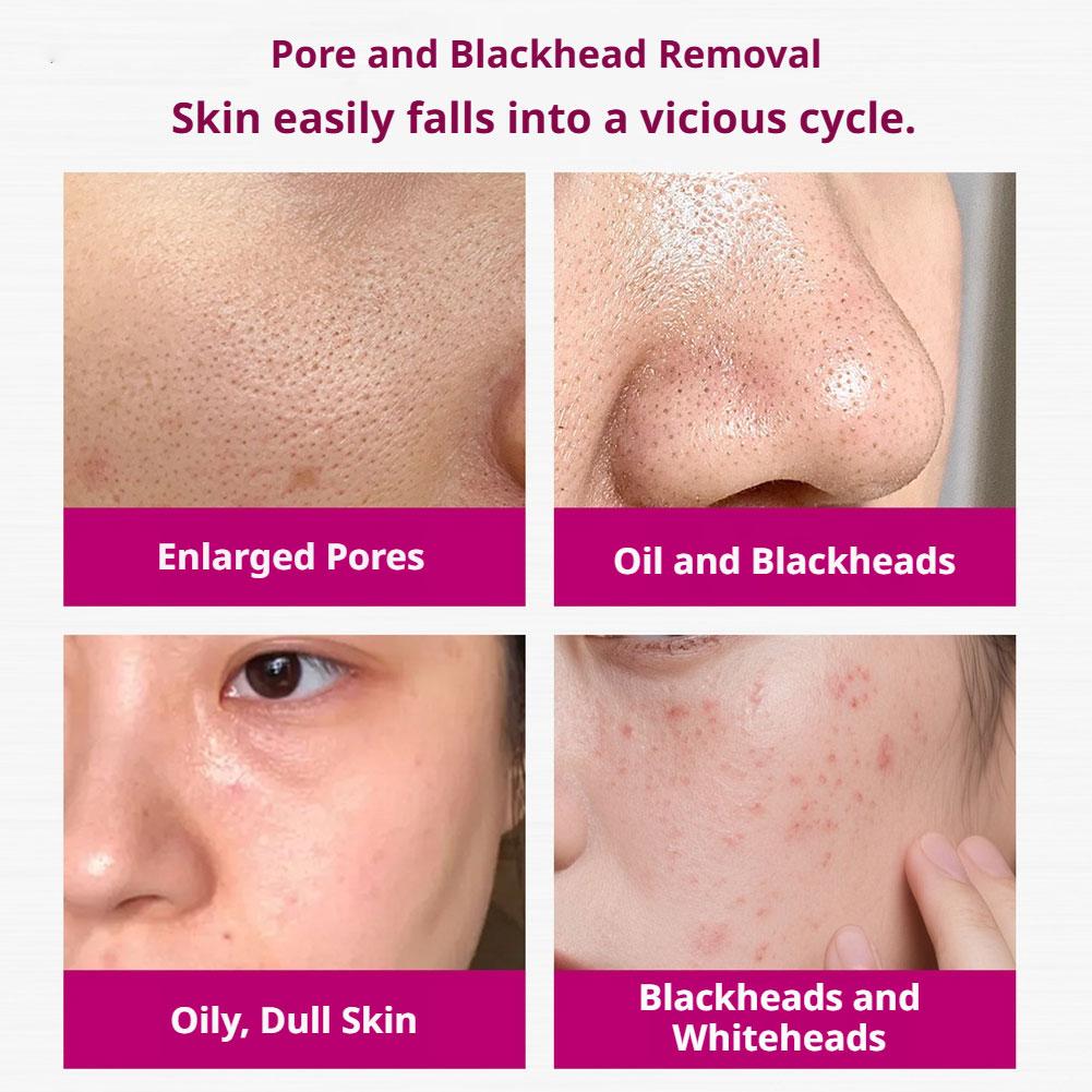 Salicylic Acid Shrink Pores Se - مراجعة Glycolic Acid Exfoliant وسعره