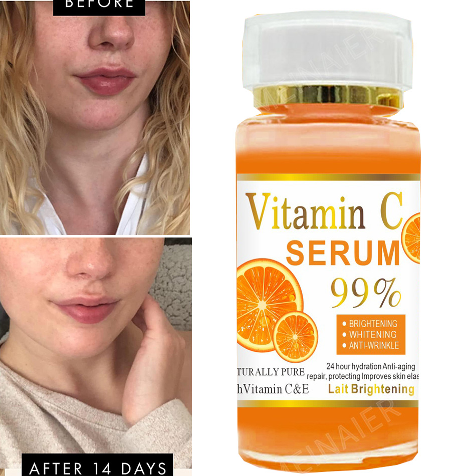 120ml 99% Vitamin C Serum Oil  - مراجعة Skincare Garnier وسعره