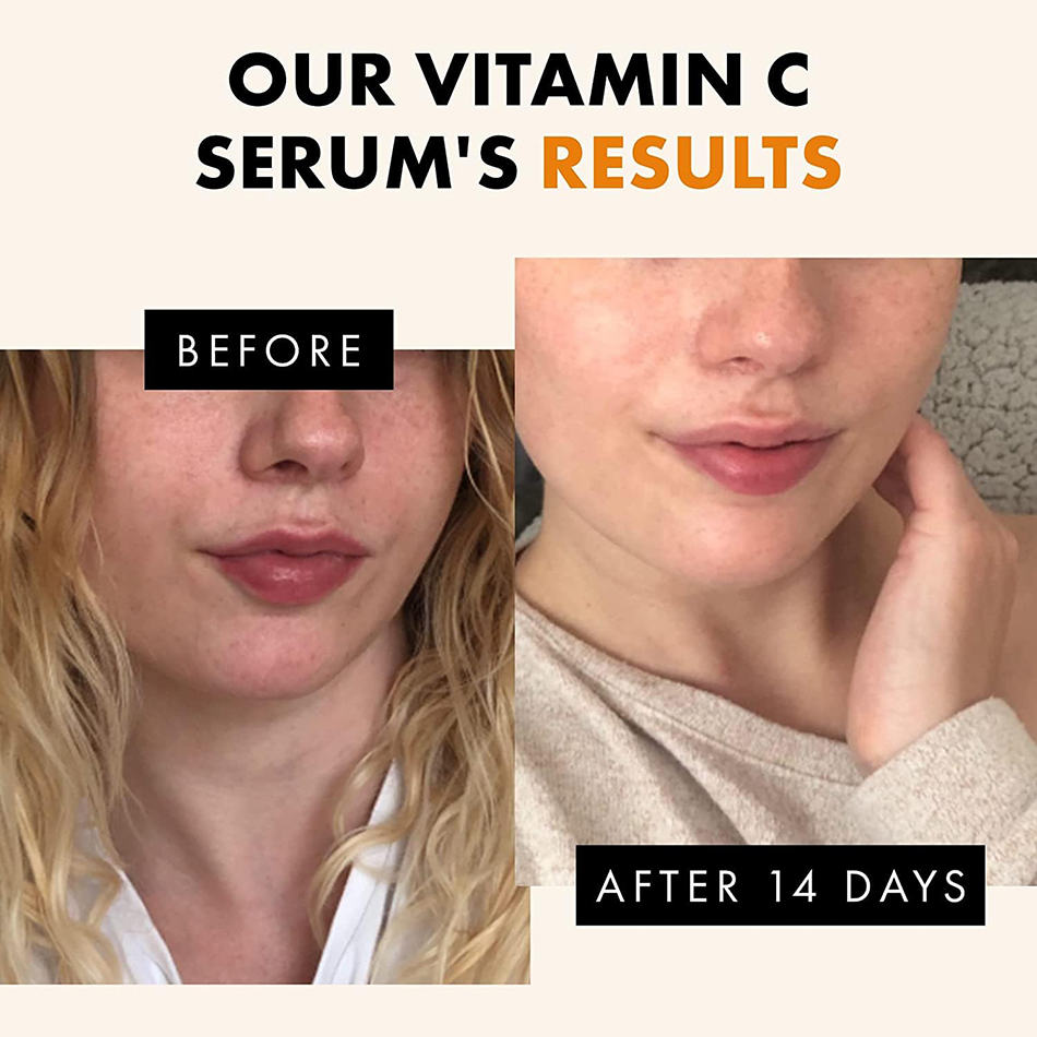 120ml 99% Vitamin C Serum Oil  - مراجعة Skincare Garnier وسعره