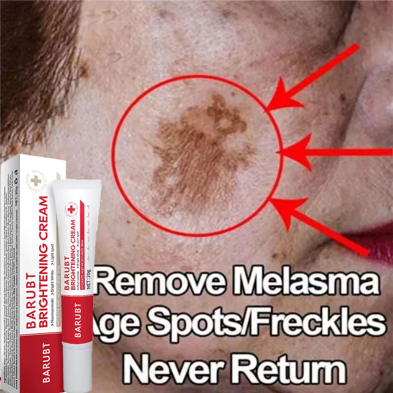 Powerful Spot-removing Whiteni - مراجعة Skincare Vitamin C وسعره