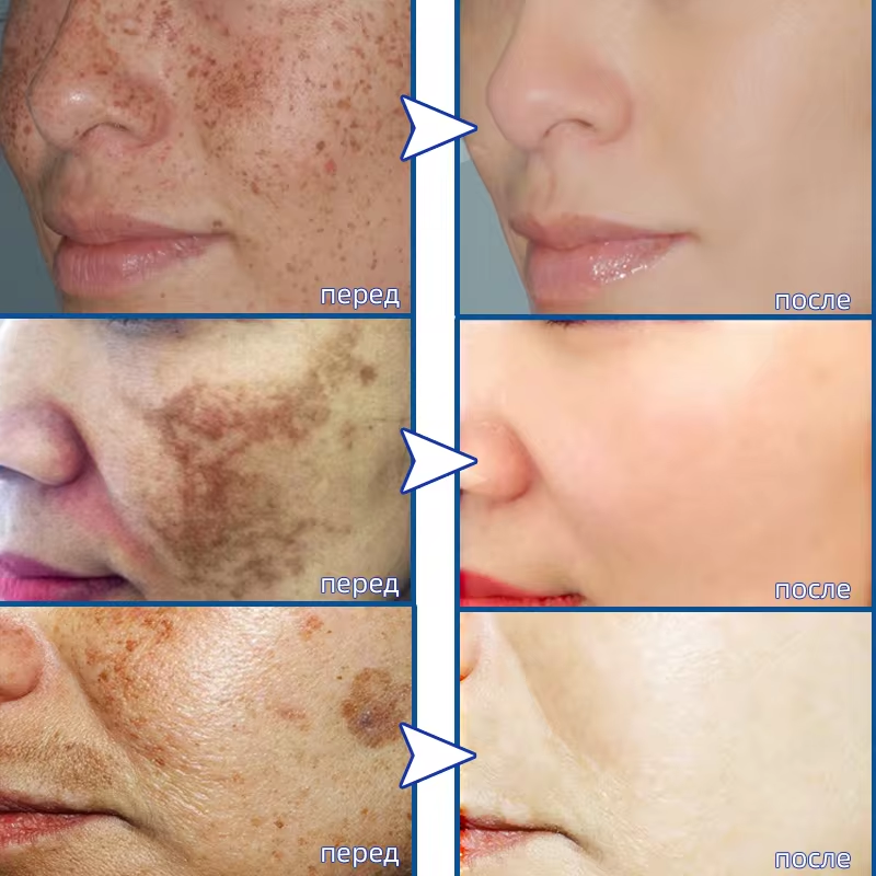 Powerful Spot-removing Whiteni - مراجعة Skincare Vitamin C وسعره
