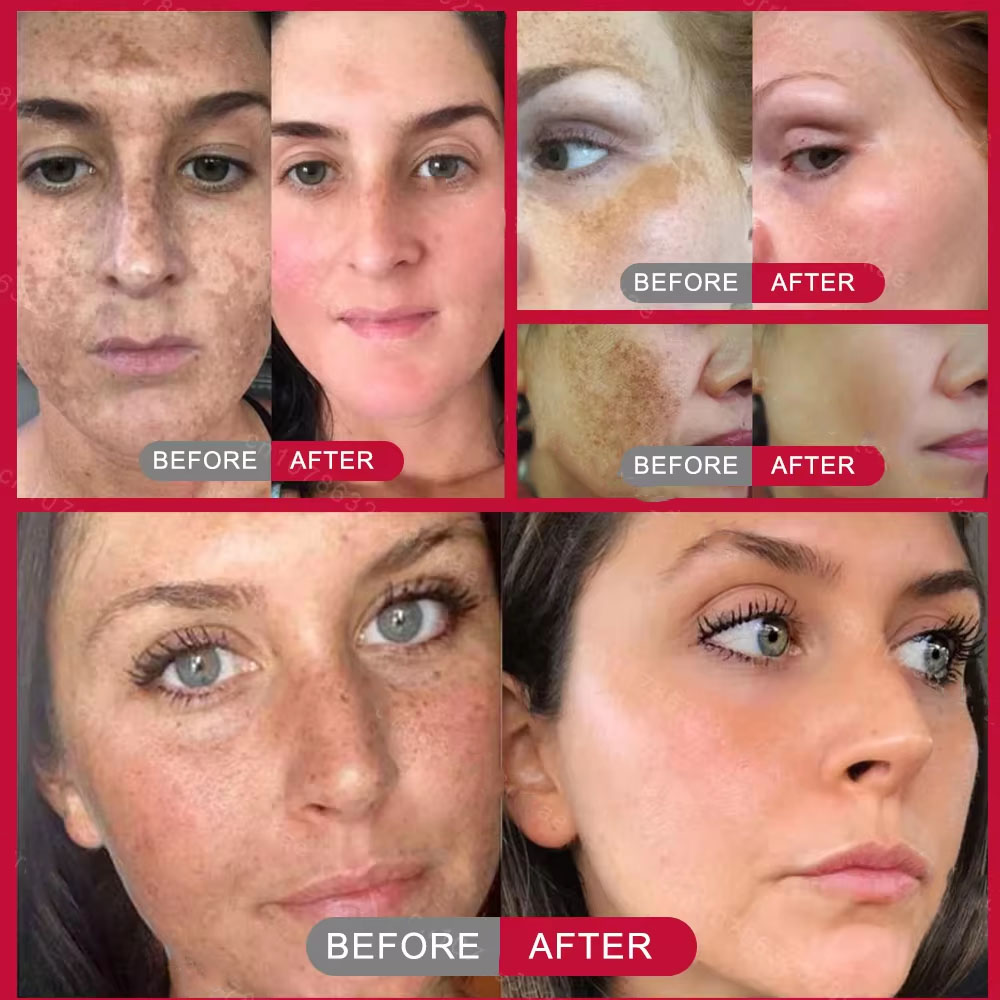Powerful Spot-removing Whiteni - مراجعة Skincare Vitamin C وسعره