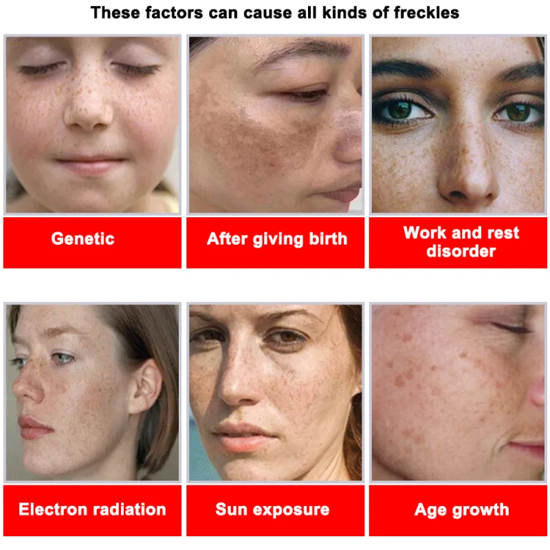 Powerful Spot-removing Whiteni - مراجعة Skincare Vitamin C وسعره