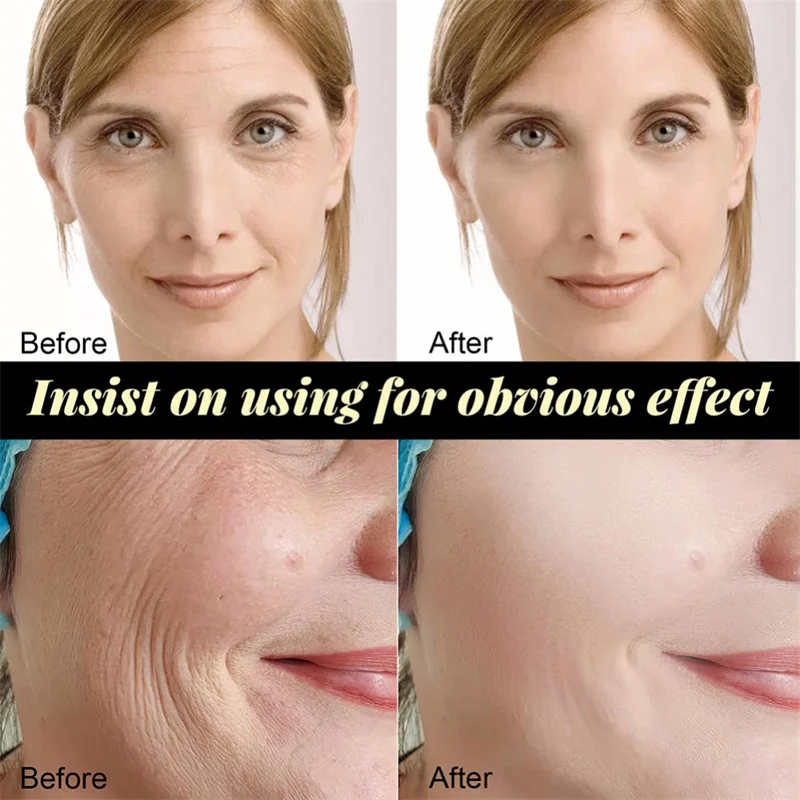 Protein Thread Lifting Kit Fac - مراجعة Skincare Garnier وسعره