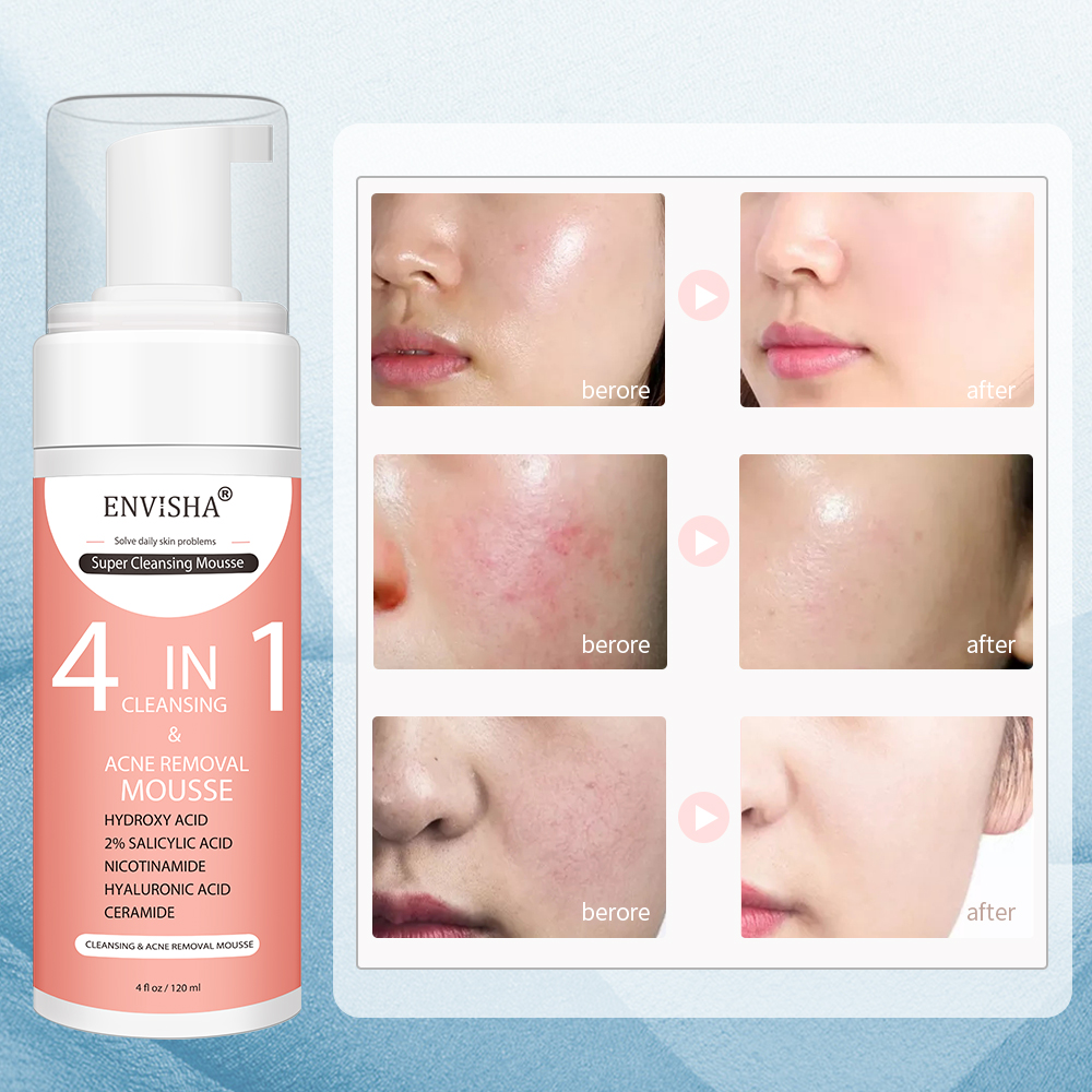 ENVISHA Facial Skin Care Exfol - مراجعة Salicylic Acid Cleanser وسعره