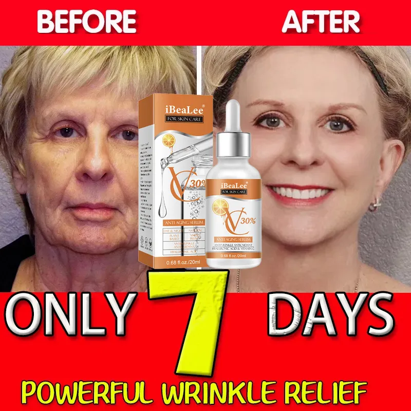 Premium 30% Vitamin C Serum Fo - مراجعة Skincare Garnier وسعره