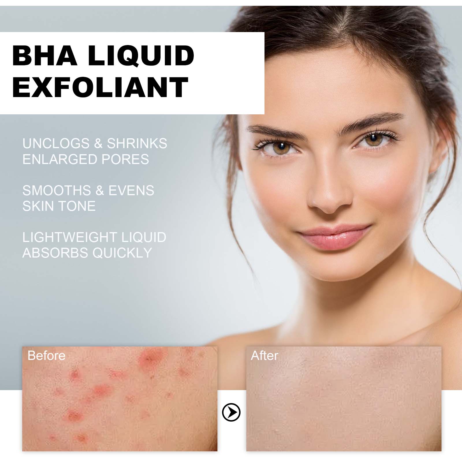 2% Salicylic Acid Liquid Exfol - مراجعة Glycolic Acid Exfoliant وسعره