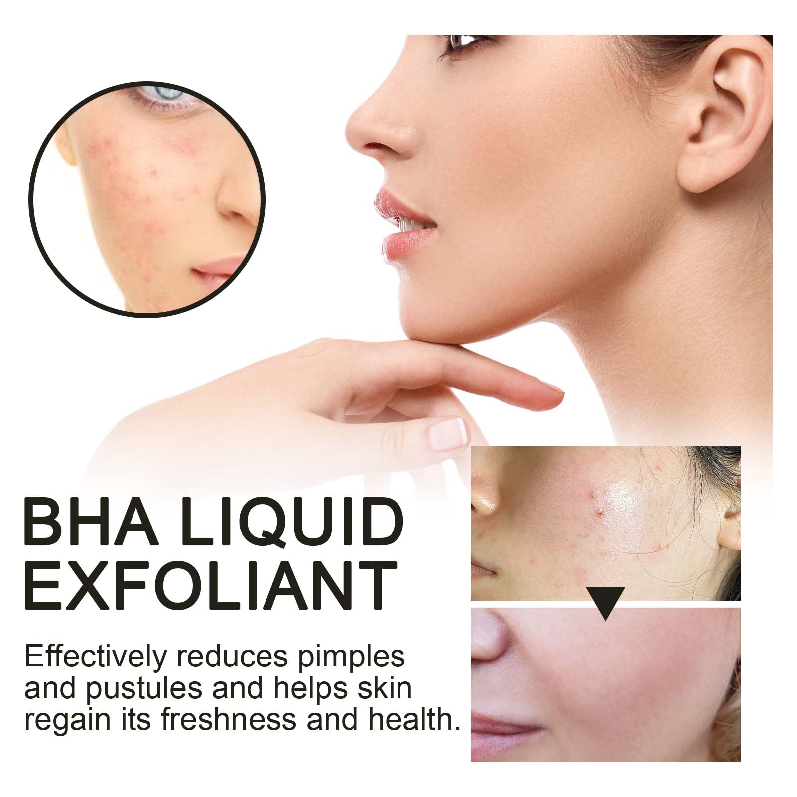 2% Salicylic Acid Liquid Exfol - مراجعة Glycolic Acid Exfoliant وسعره