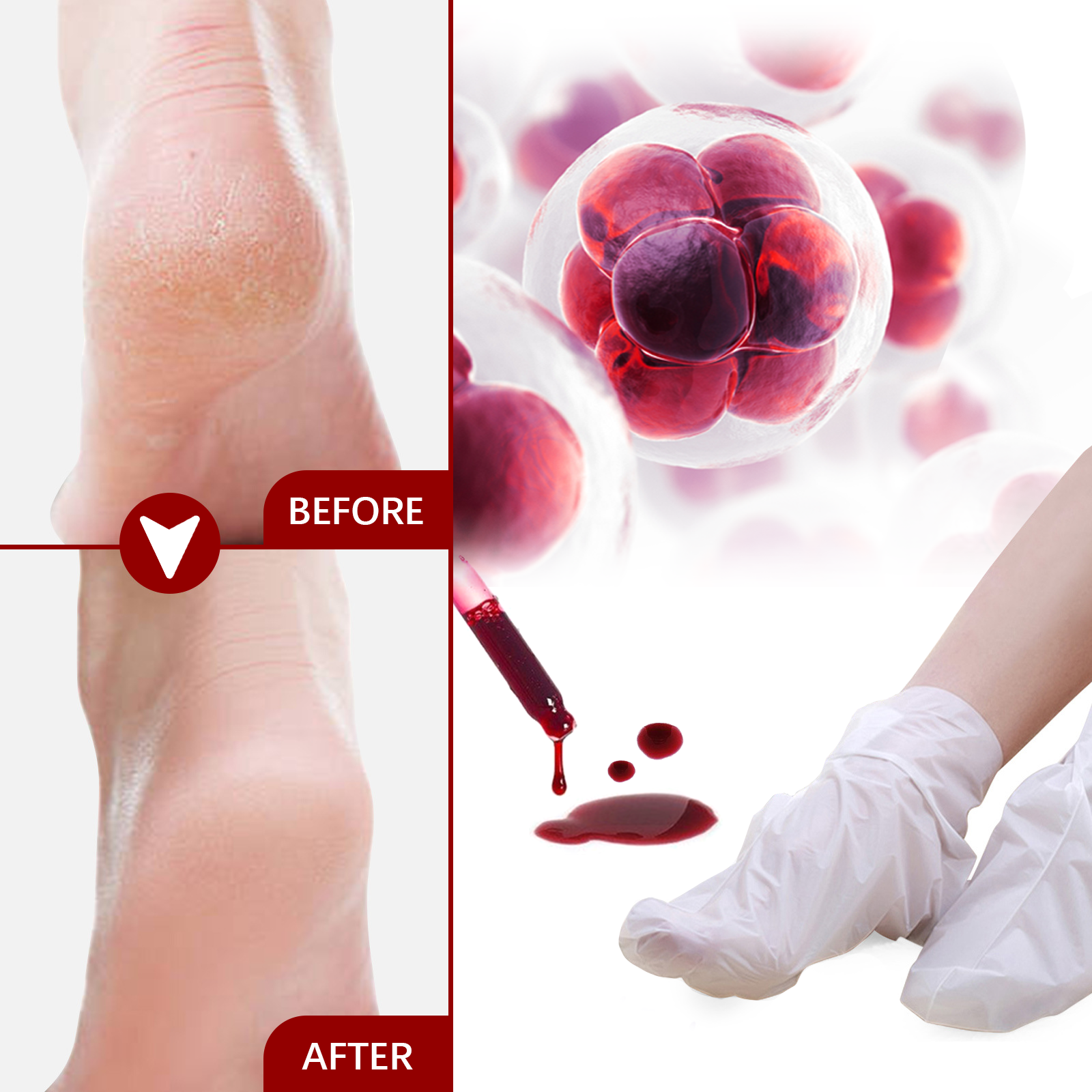 AHA Exfoliating Foot Mask Mois - مراجعة Glycolic Acid Exfoliant وسعره