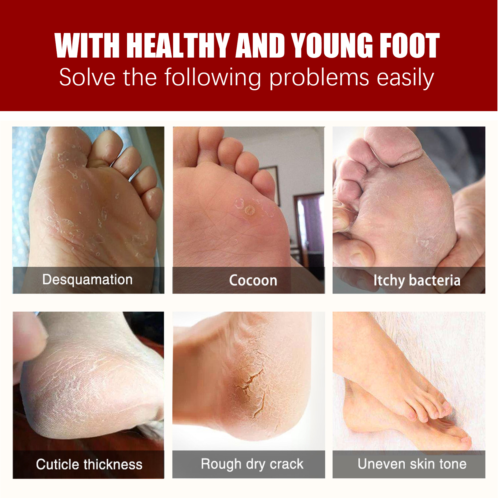 AHA Exfoliating Foot Mask Mois - مراجعة Glycolic Acid Exfoliant وسعره