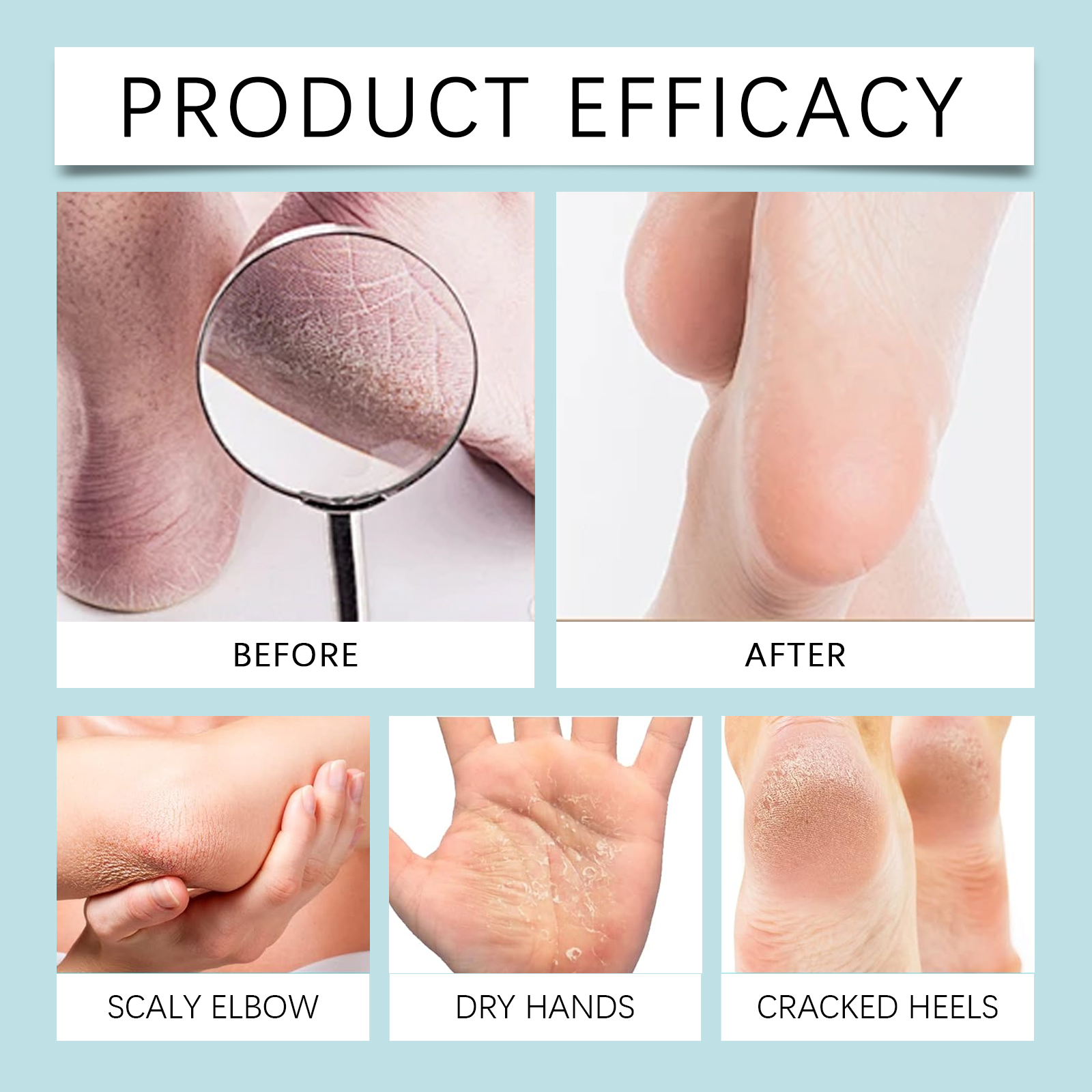 10% Urea Cream +2% Salicylic A - مراجعة Glycolic Acid Exfoliant وسعره