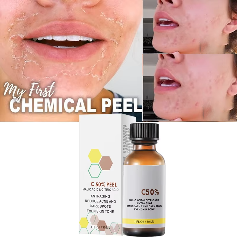 With Malic Acid And Citric Aci - مراجعة Salicylic Acid Cleanser وسعره