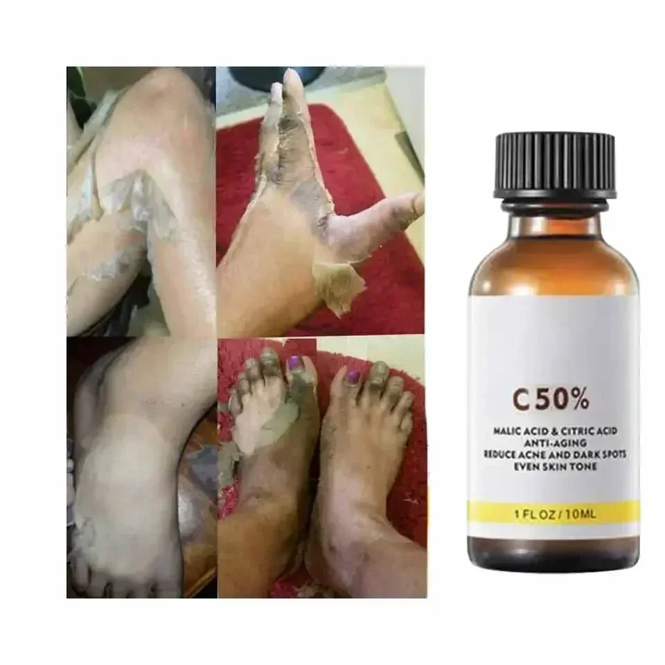 With Malic Acid And Citric Aci - مراجعة Salicylic Acid Cleanser وسعره